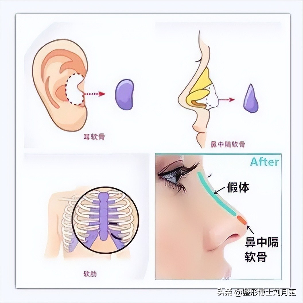 深圳做鼻子最权威的整形医院,深圳军科医疗美容中心