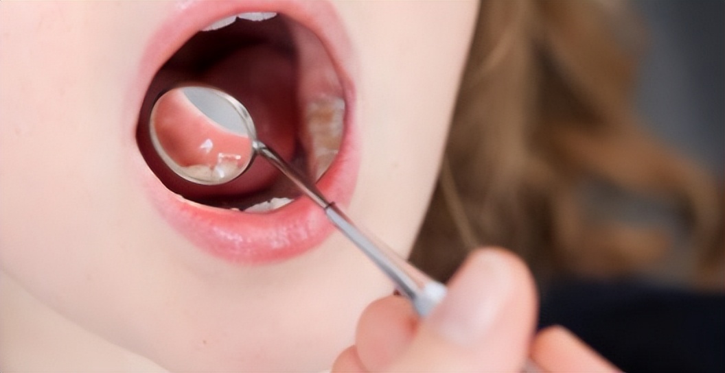 喂养母乳的十大禁忌,喂养宝宝拒绝奶瓶怎么办