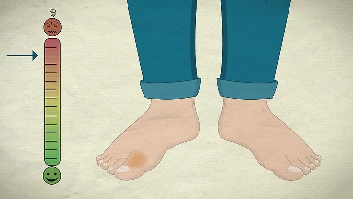 脚趾骨折断端稍分离移位,判断脚趾是骨折还是损伤的方法