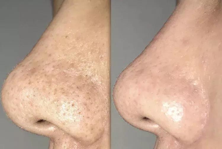 清洁泥膜合集,学生清洁泥膜推荐