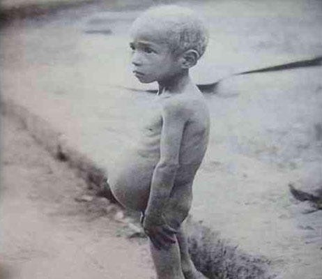 故事:非洲22岁小伙吃沙子上瘾,一天要吃五斤,身体发生怎样改变