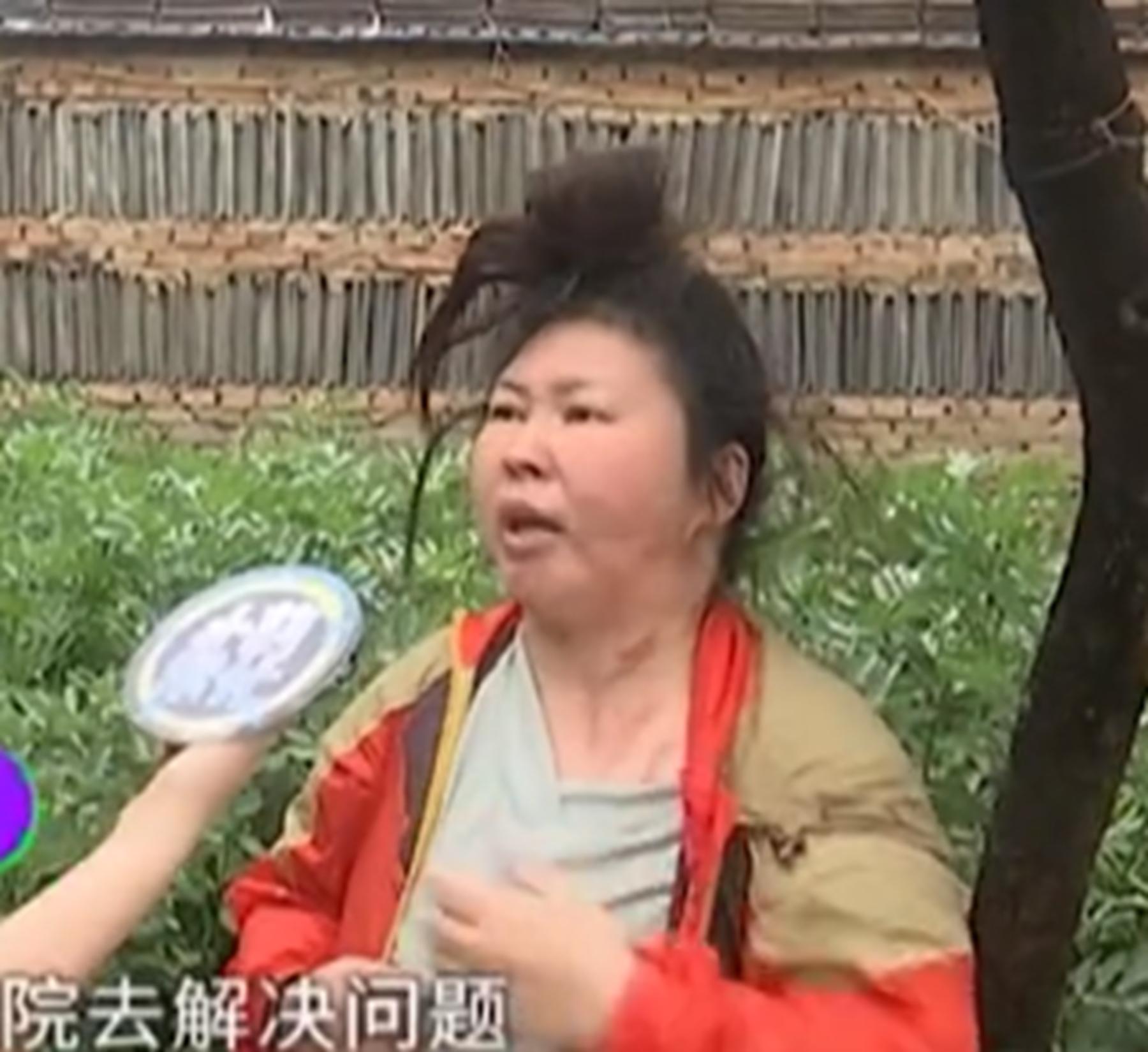 女子拔罐二度烧伤后续,女子拔火罐被烧伤后续