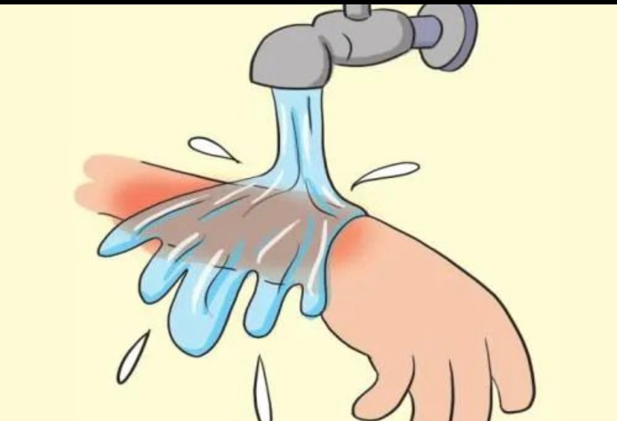 孩子烫伤后的急救步骤要记牢,儿童被烫伤医生处理视频