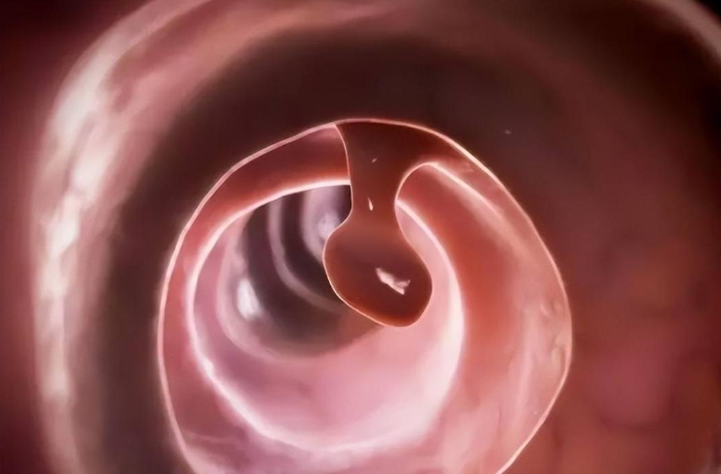 化痰散结，这几味虫类药材，助你“吃掉”肠息肉