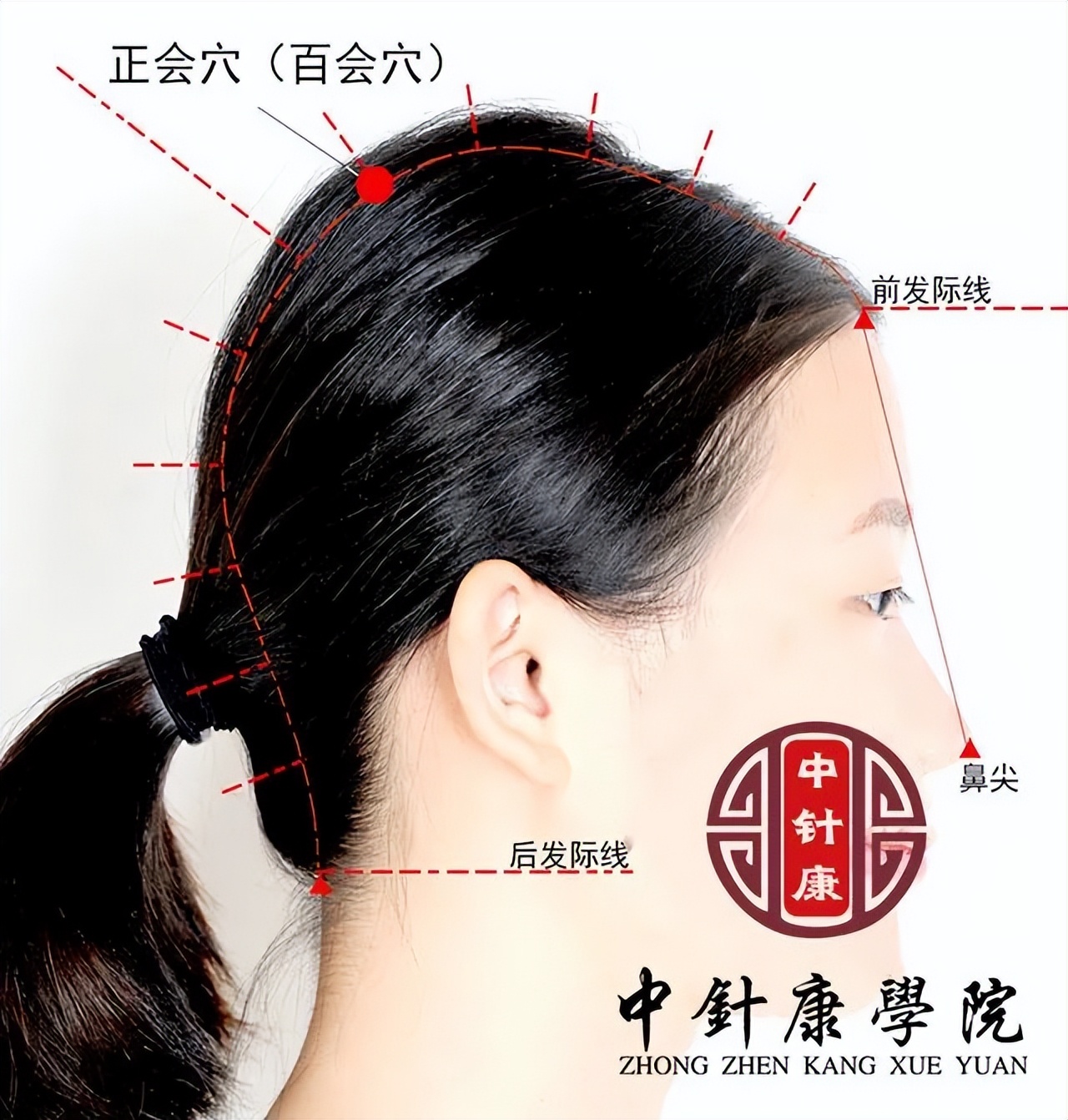 董氏二针疗法,董氏奇穴三阴二阳常用穴位