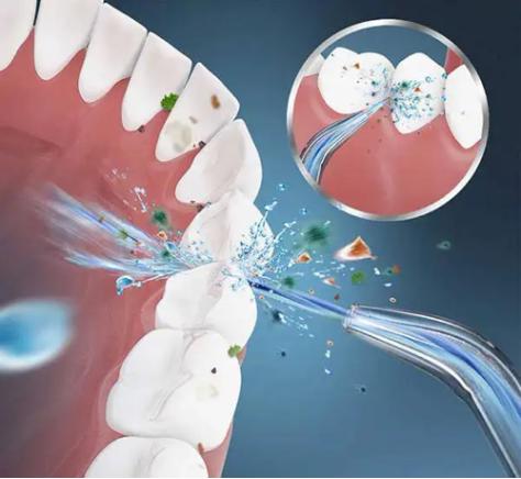 冲牙器品牌十大排名洁碧,水牙线冲牙器推荐第一名