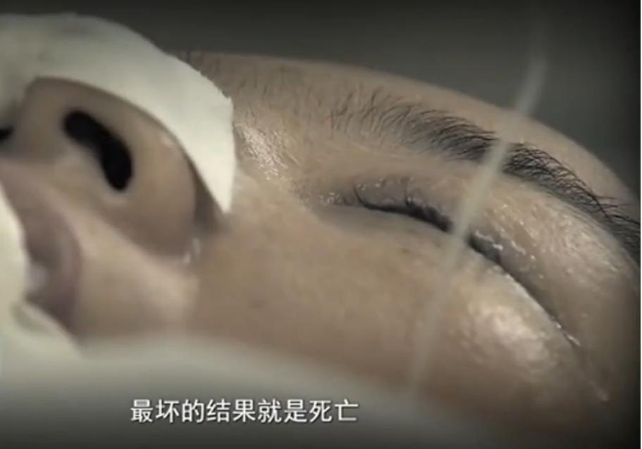 美女重伤成植物人，男友一家一起照料，美女醒来后让小伙左右为难