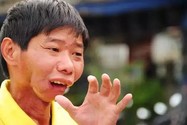 槟榔的危害原来这么大,槟榔的危害你知道有多大吗