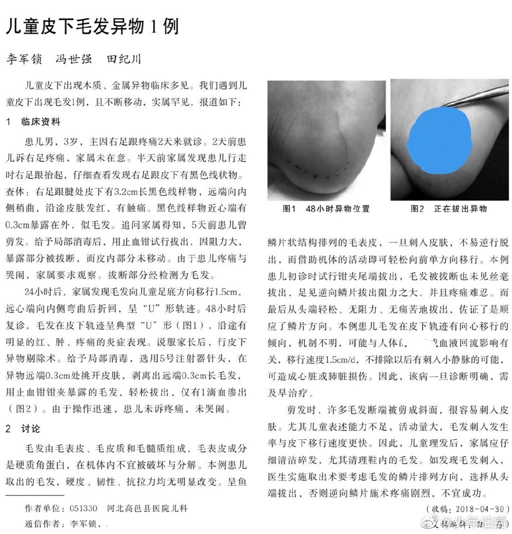 头发硬但是发量少需要烫吗,头发硬能扎到肉里