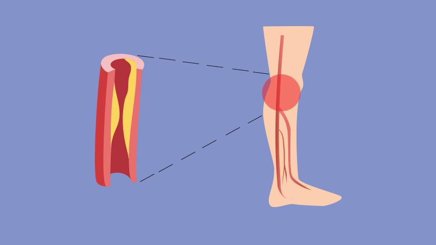 专治老年人下肢无力的方法,老年人下肢无力吃什么药