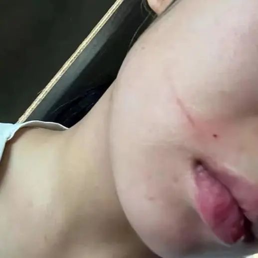 怀孕七个月有时被孩子打没事吧,孕四个月被棍子打到肚子上