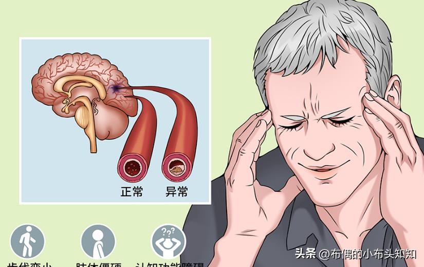 53岁女子确诊外阴癌,她的“坏习惯”为所有人敲响警钟,值得借鉴