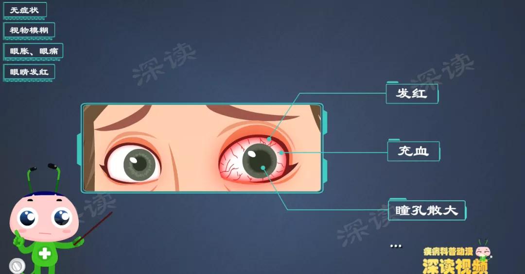 视物模糊？畏光流泪？细数第二大致盲眼病——青光眼致盲前啥征兆