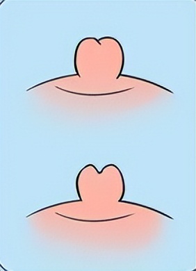 胸部长的褐色小点是什么,女生胸部上长了白色小点点