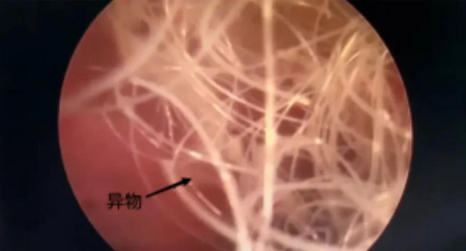 6岁女童隐私部位出血1个月，原因万万没想到，家有女娃要注意了！