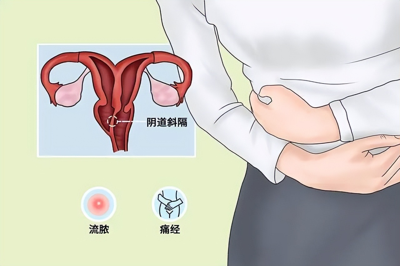 女子检查身体发现自己有两个子宫,女子查出有两个子宫