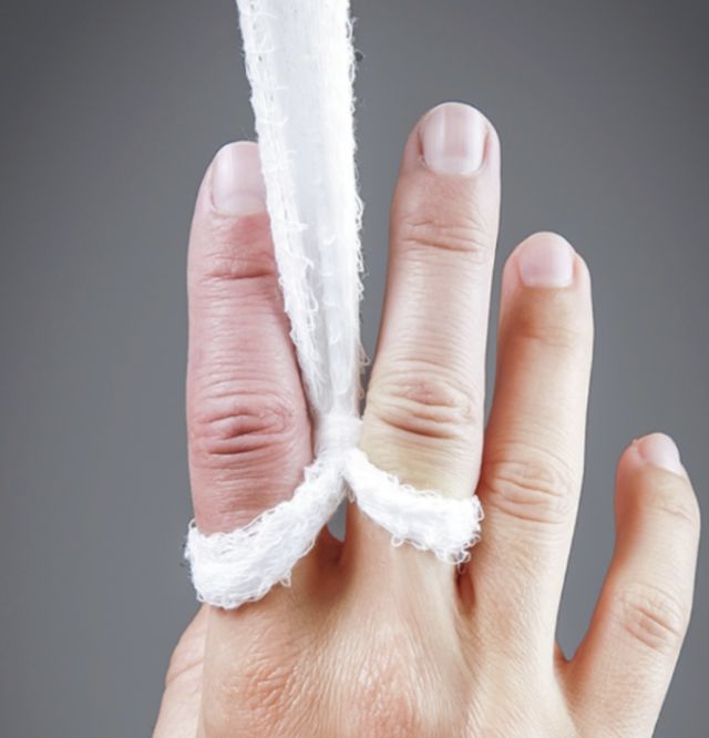 第一掌骨基底部骨折手法复位,骨折手法复位原理