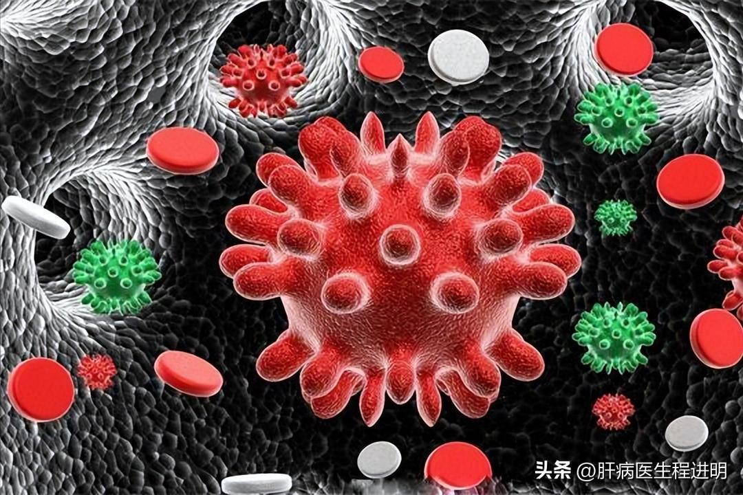 得了乙肝为啥自己不知道,这么多年为什么乙肝还不能治愈