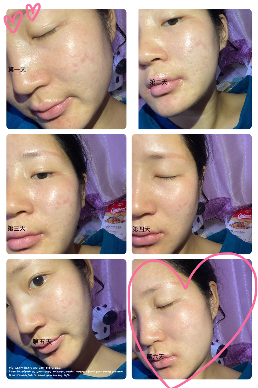 寻荟记芦荟胶真实测评,李佳琦寻荟记芦荟胶