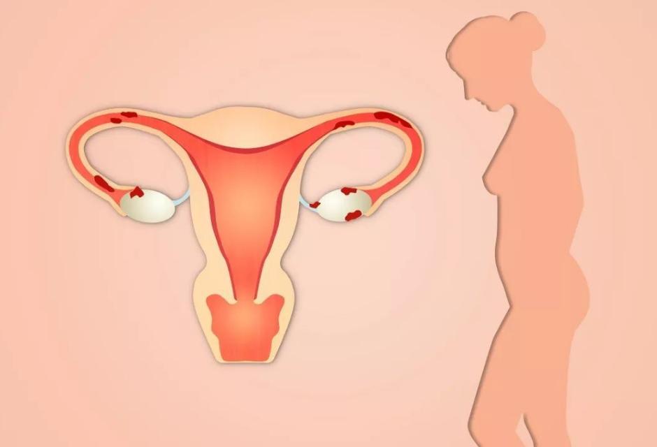 内裤好多分泌物代表什么,女性裤头总有异味怎么回事