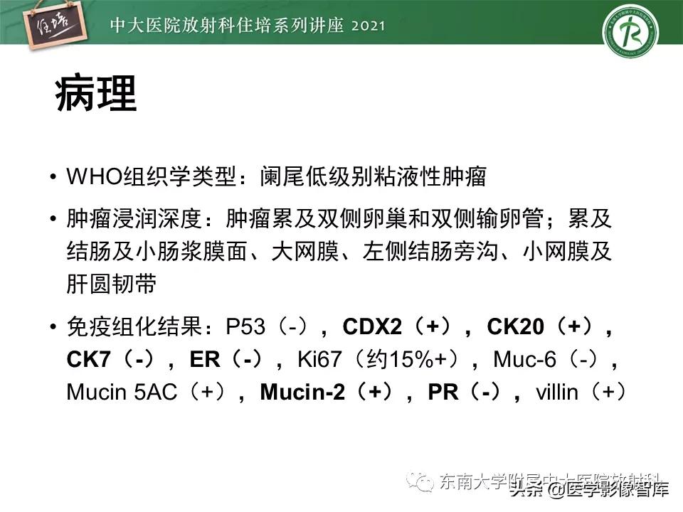 卵巢浆液性肿瘤的肉眼及镜下特征,卵巢原发性粘液性囊腺瘤