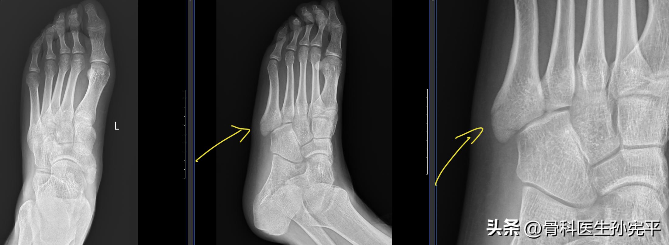 医学影像趣图,震撼的医学影像