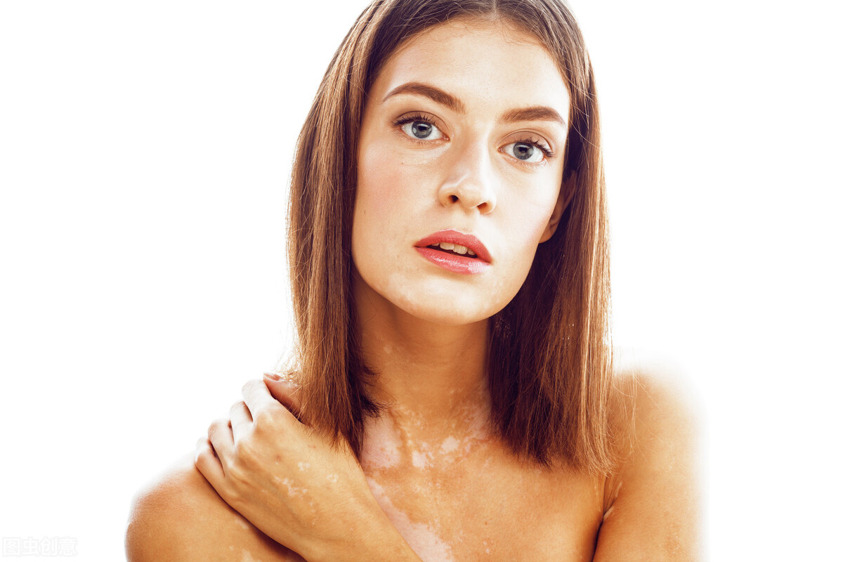 腿上得白癜风该如何治疗,白癜风一般会先出现在腿上吗