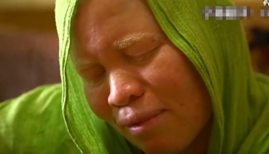 非洲医疗有多恐怖？小伙患上前列腺，医生竟用锤子砸胸口祛除病魔