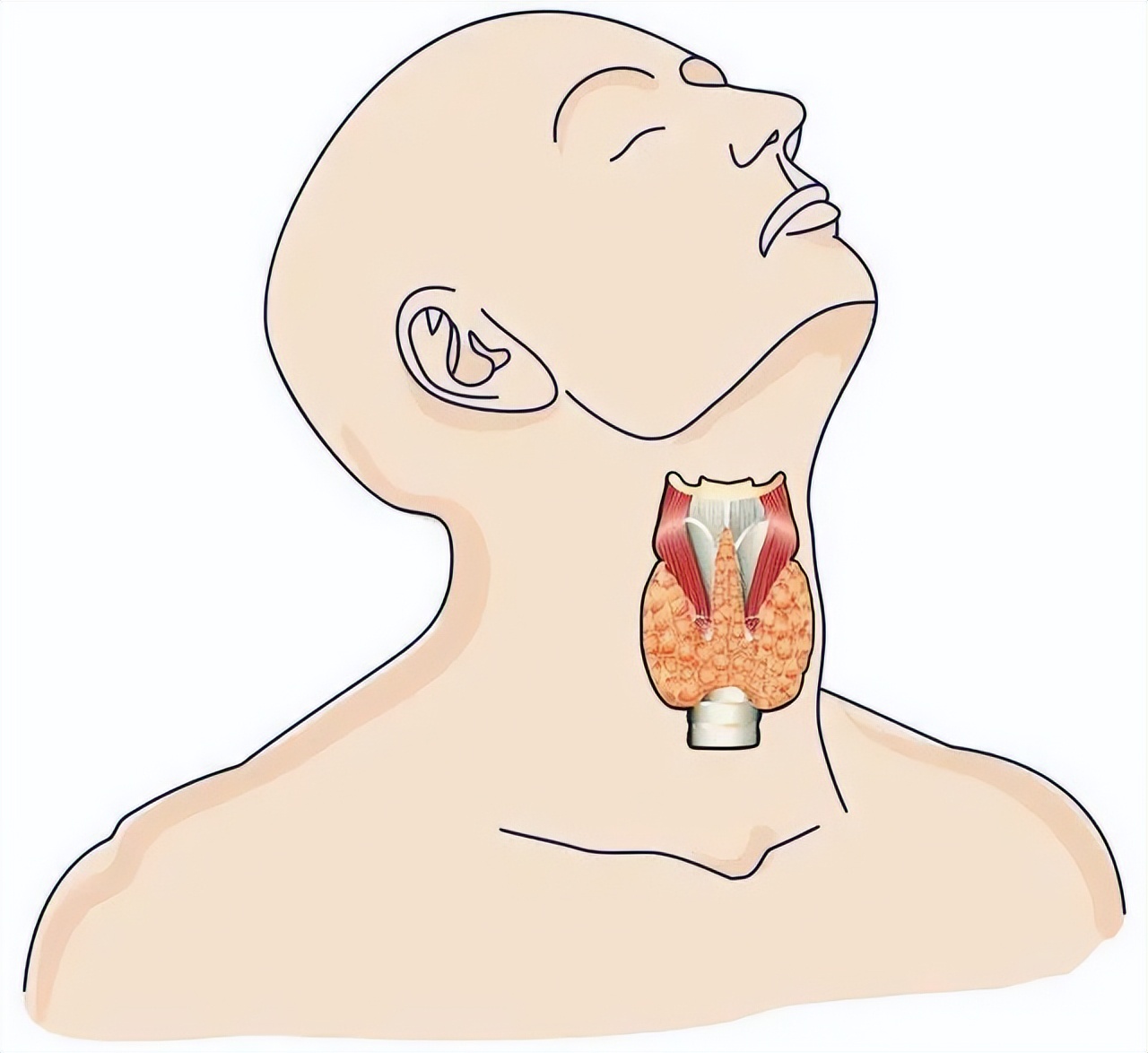 甲状腺癌是“懒癌”?别低估其破坏力