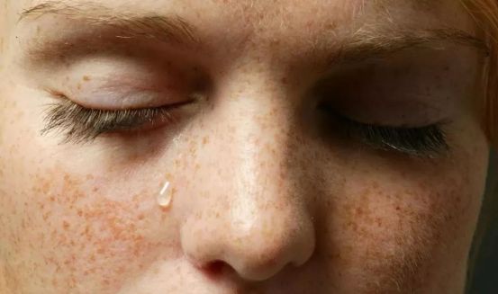 祛斑秘诀告别斑点恢复白皙肌肤,能真正美白祛斑的小妙招