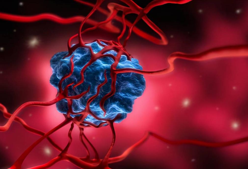 警惕这些痣可能会成瘤,哪些地方有痣代表得癌症了