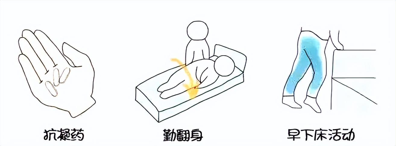 下肢静脉血栓患者能做康复训练吗,膝盖手术后下肢静脉血栓康复训练