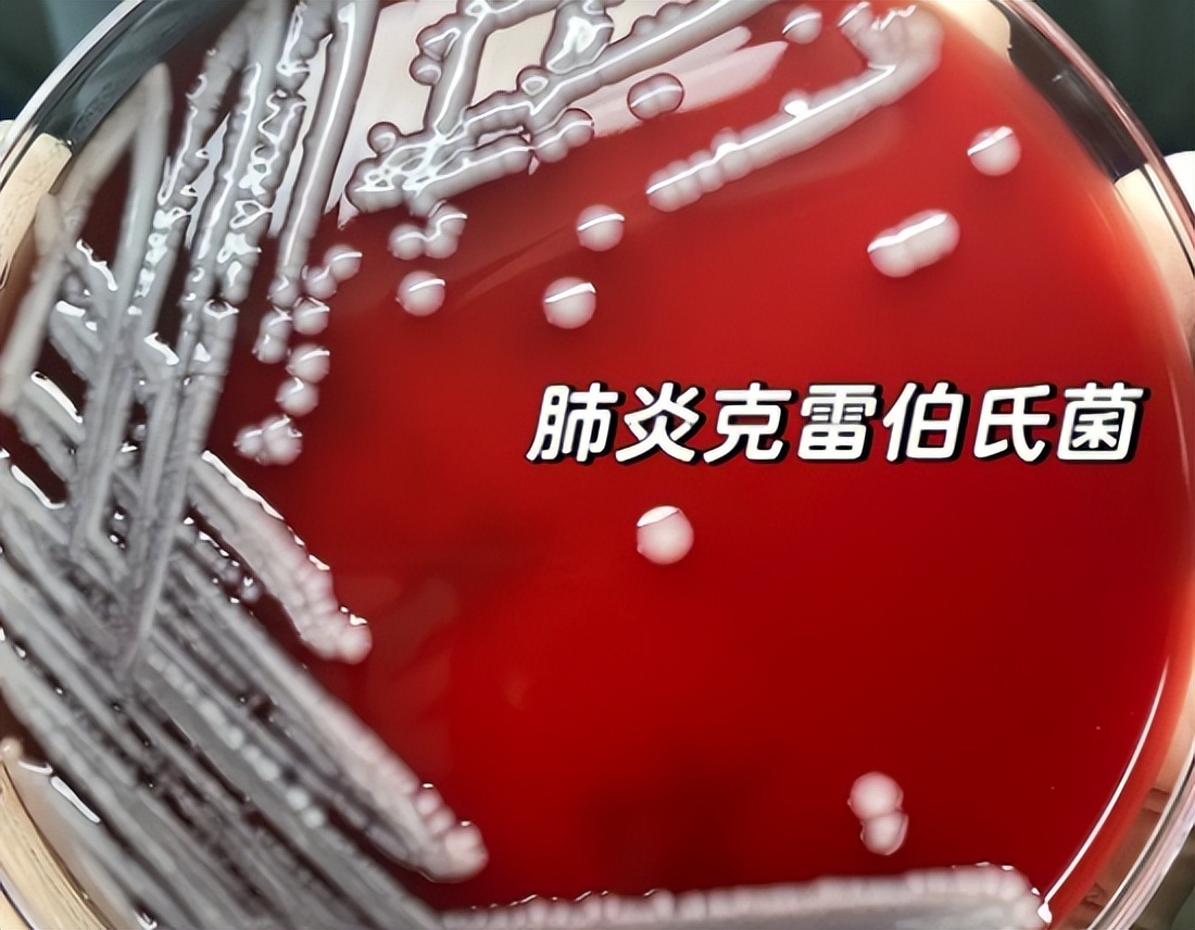 医院内尿路感染常见的诱因,尿路感染最严重的后果