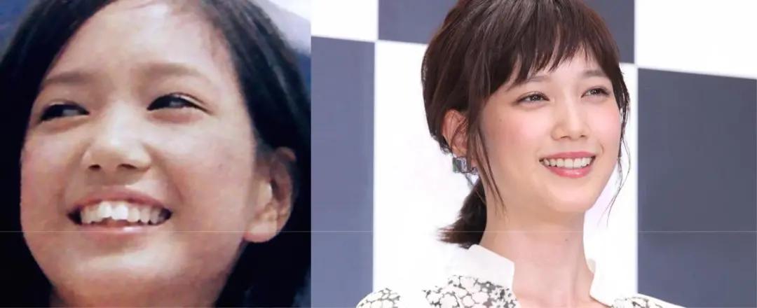 日本整牙的明星,日本整牙明星