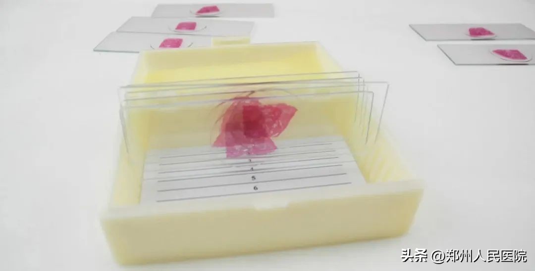 切片？捞片？烤片？听着你像在做菜，你却说在“破案”！