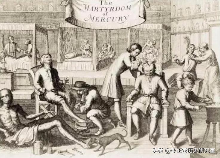 水银与碘化钾治疗梅毒,中世纪水银治疗梅毒