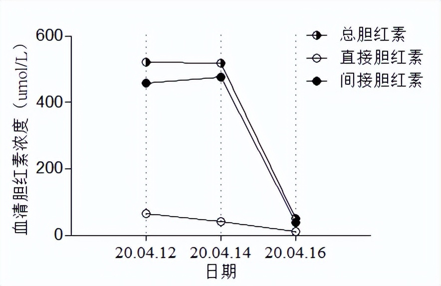 蚕豆病导致的溶血性黄疸的特点,蚕豆病溶血性黄疸一般多久消退
