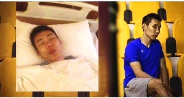 李宗伟抗癌经历完整版,李宗伟抗癌治疗花费