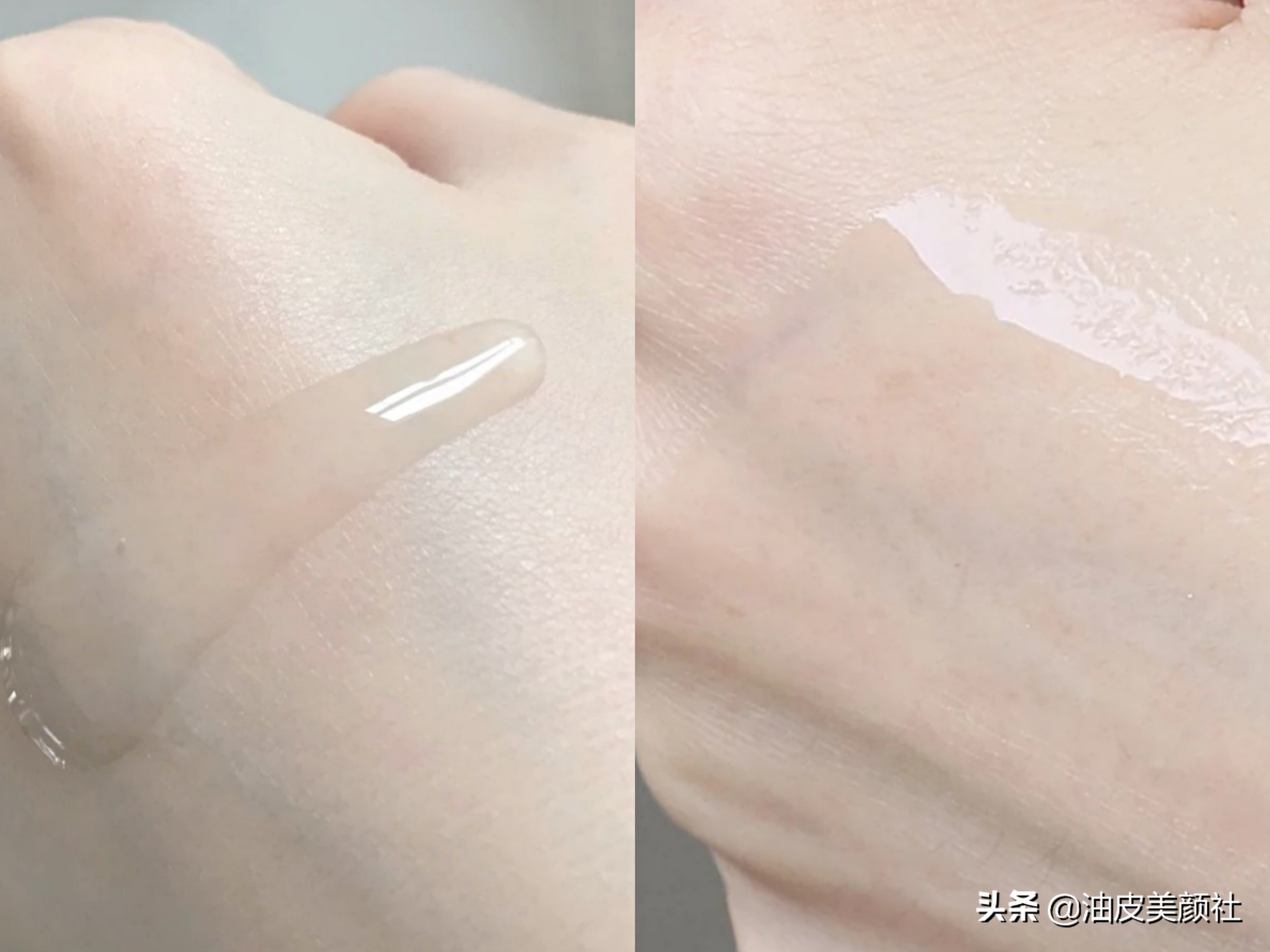 公认最好用的4款美白精华,哪个牌子的精华美白抗衰老效果好