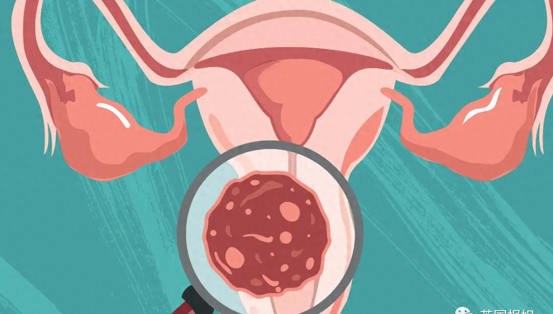 全球最美女人之一去世，仅26岁！曾在中国参加选美比赛，外网悼念