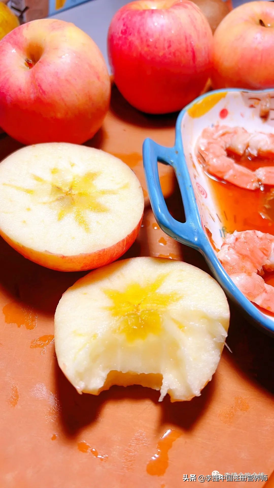 膳食纤维糖有用吗,膳食纤维丰富有益健康