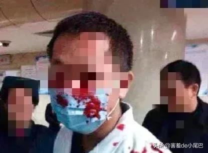 妹子怀孕做b超,女子怀孕却被做手术后续