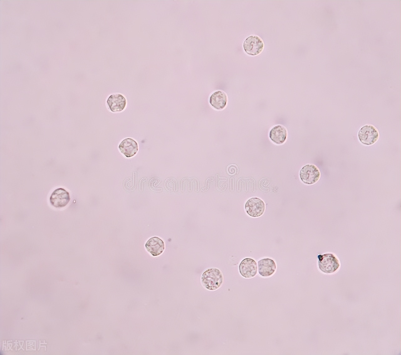 尿常规解析,尿常规检查如何读懂60秒教会你