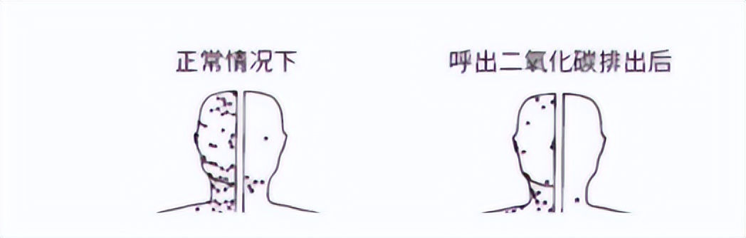 血型问题蚊子老咬我怎么办,蚊子爱咬我是因为血型么