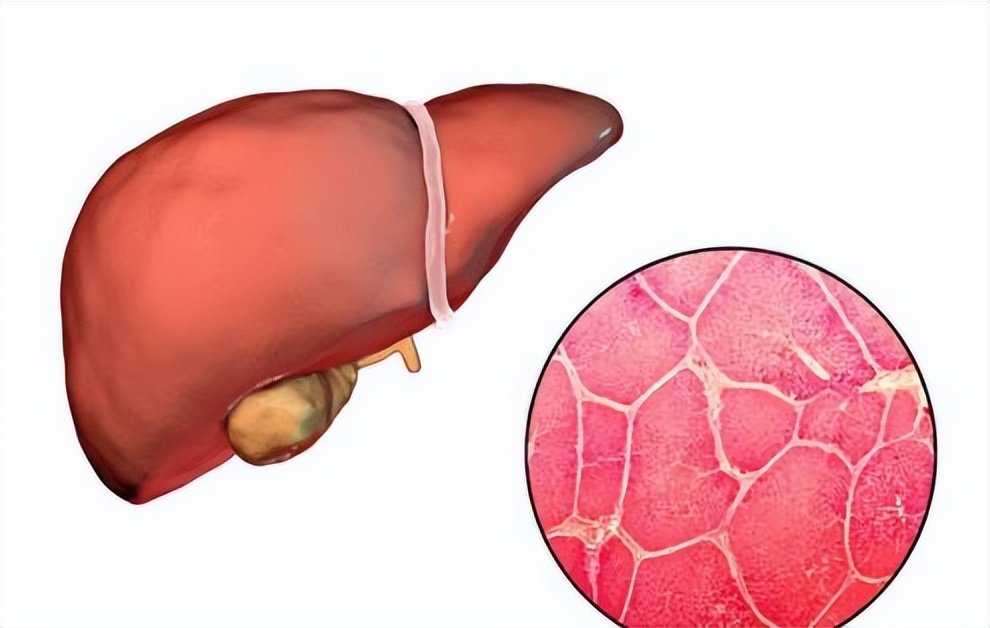 形成囊肿了该怎么把囊肿消下去呢,医生提醒大多数囊肿无需处理