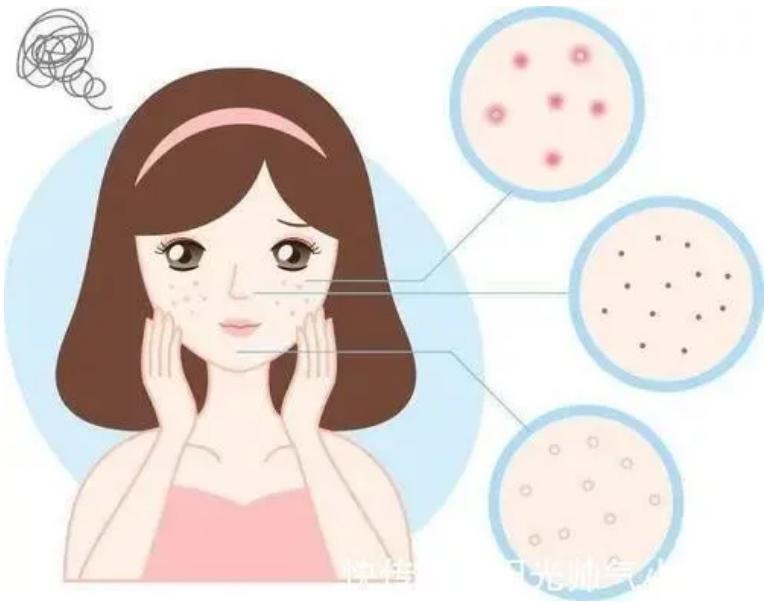 过敏性皮炎干燥红痒是怎么回事,干燥性过敏皮炎的症状