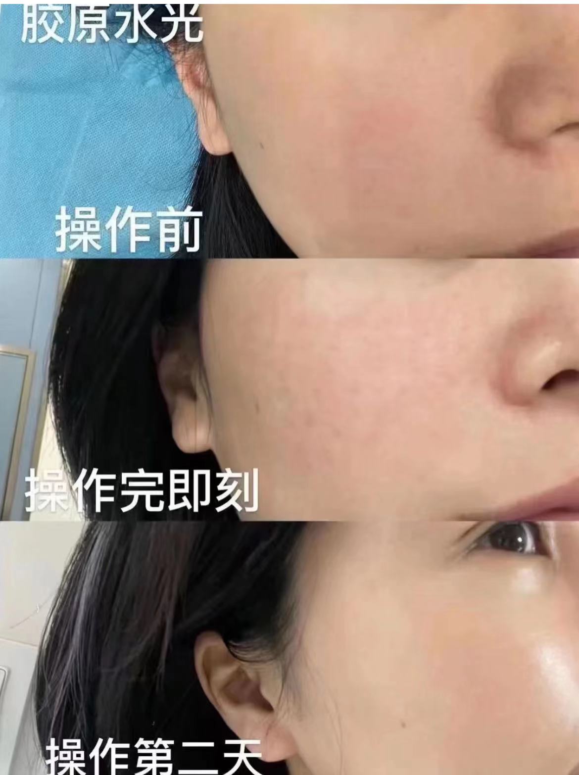 40岁的抗老精华有哪些国货,40岁抗老紧致用哪个精华好点