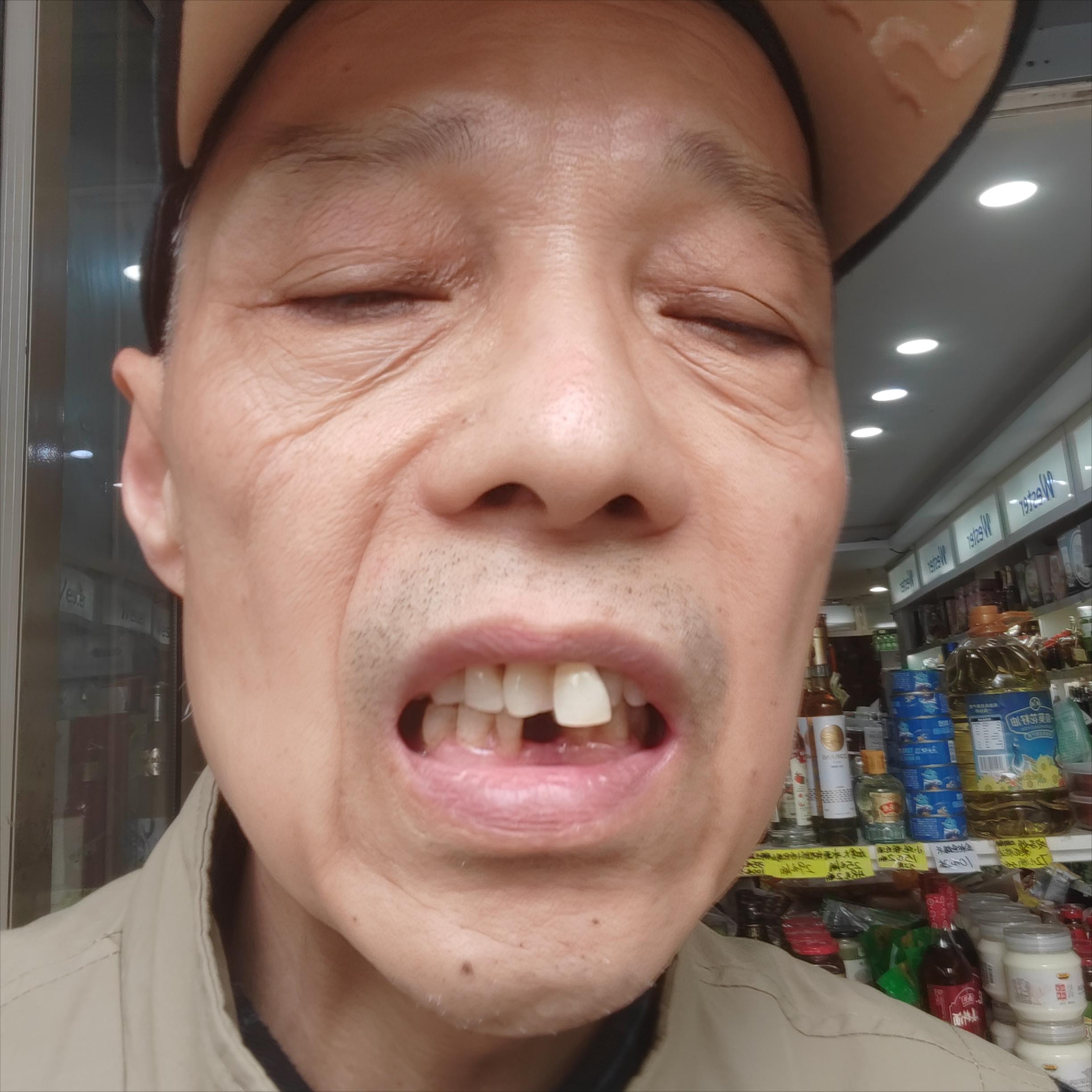 今天抽了牙髓之后还是疼,抽了牙神经后没有做根管