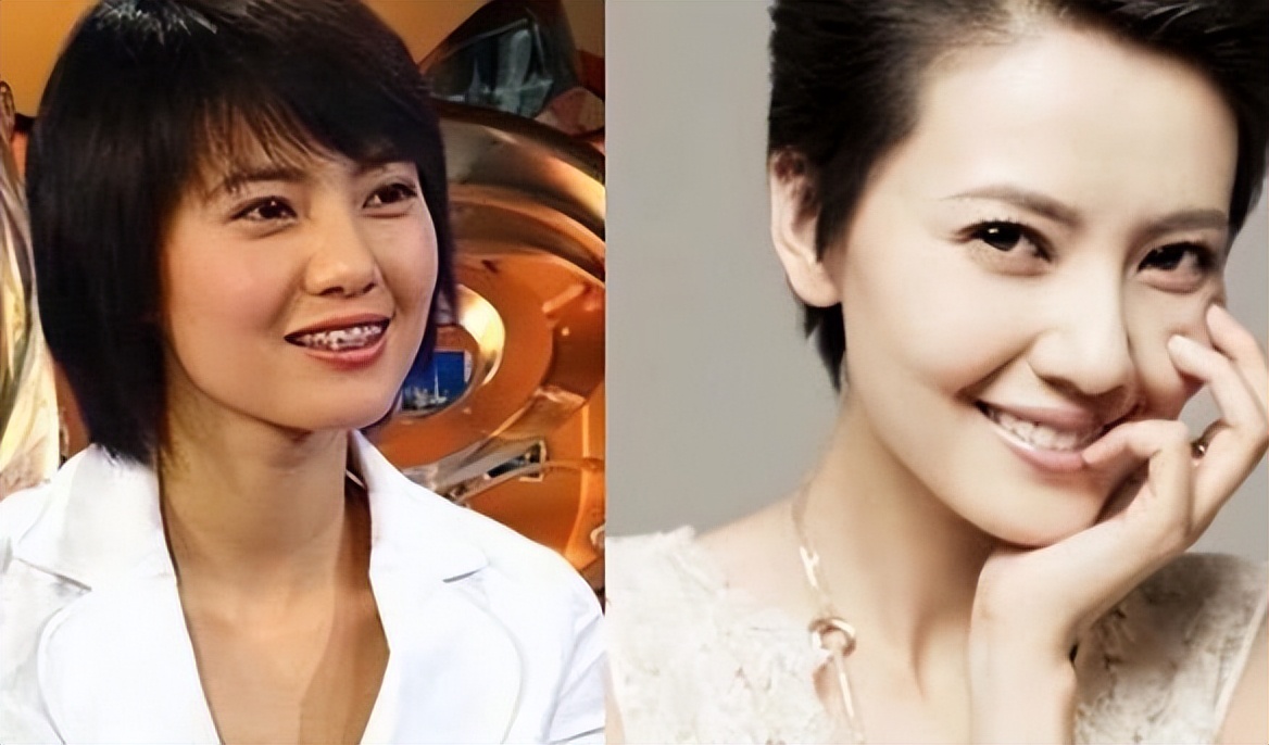 垫屁垫，烤瓷牙，戴美瞳：这些女明星的修修补补，看得人眼花缭乱