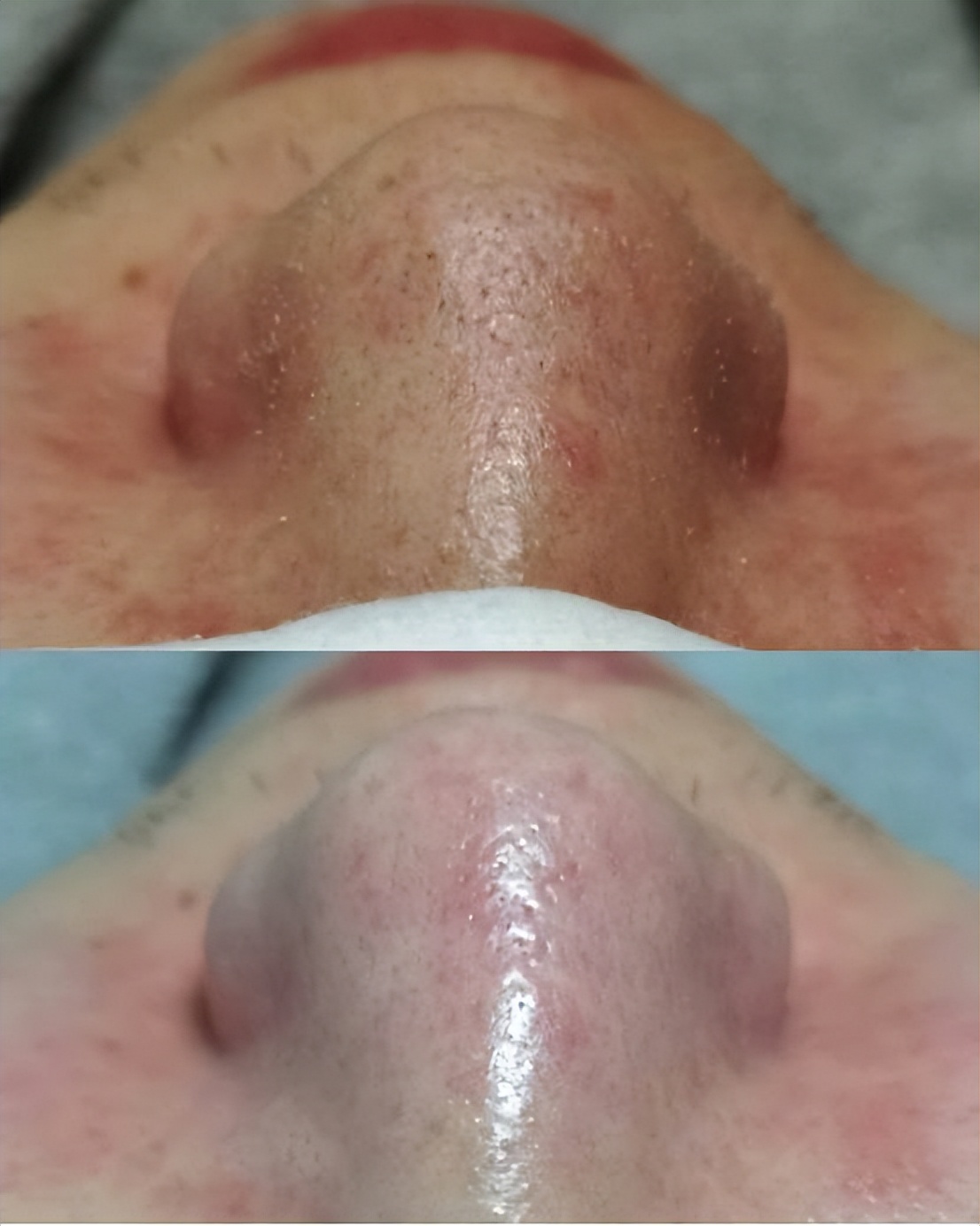 上完粉底液鼻子上有白点,涂粉底液后毛孔有白点点